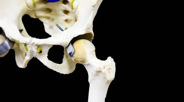 stock image photograph of articulated hip joint in black background