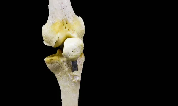 Fotografia dell'articolazione articolata del ginocchio su sfondo nero — Foto Stock