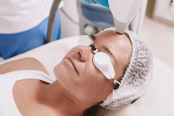 Снимок Зрелой Женщины Получающей Лечение Лазерной Эпиляции Лица Клинике Красоты — стоковое фото