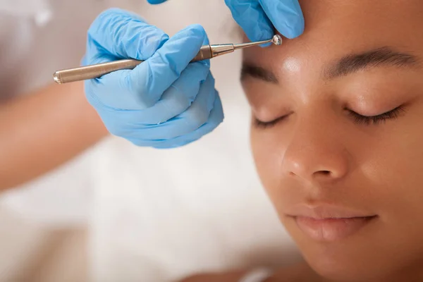 一位美容师剪下女性病人额头上的黑头的照片 — 图库照片