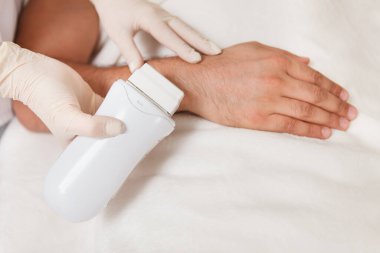 Kozmetikçi erkek müşterinin koluna sıcak ağda uyguluyor. Ağda kavramı