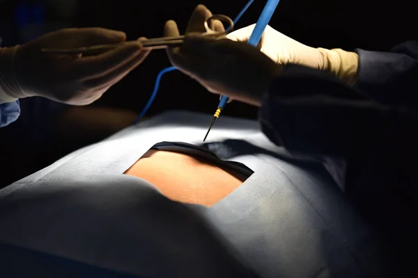 Хірургічне Світло Операційній Підготовка Початку Хірургічної Операції Розрізом Командний Хірург — стокове фото