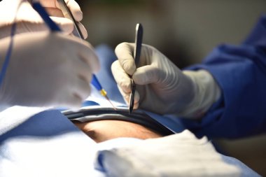 Ekip cerrahı ameliyathanede. Ameliyathanede cerrahi ışık. Ameliyat için hazırlıklar bir kesikle başlıyor. Cerrah hastayı ameliyat ediyor..