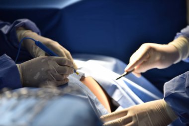 Ekip cerrahı ameliyathanede. Ameliyathanede cerrahi ışık. Ameliyat için hazırlıklar bir kesikle başlıyor. Cerrah hastayı ameliyat ediyor..