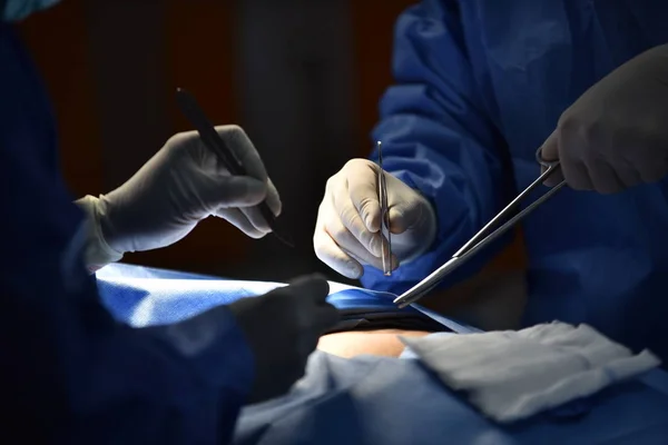 Operating Room.scrub nurse preparing medical instruments for operation.Medical Team Performing Surgical Operation in Modern Operating Room.Equipment and medical devices in hybrid operating room blue filter, Surgical procedures, the operating room