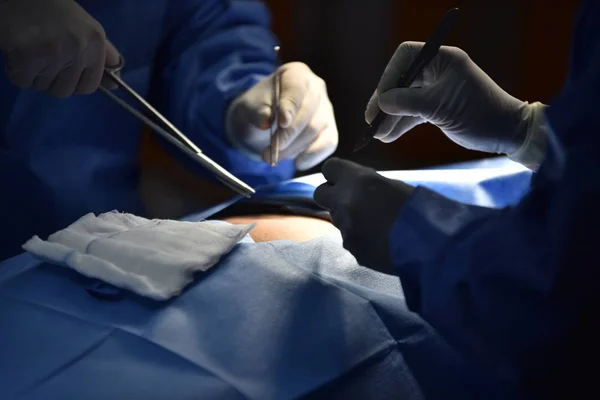 Operationssaal Peeling Krankenschwester Bereitet Medizinische Instrumente Für Die Operation Medical — Stockfoto
