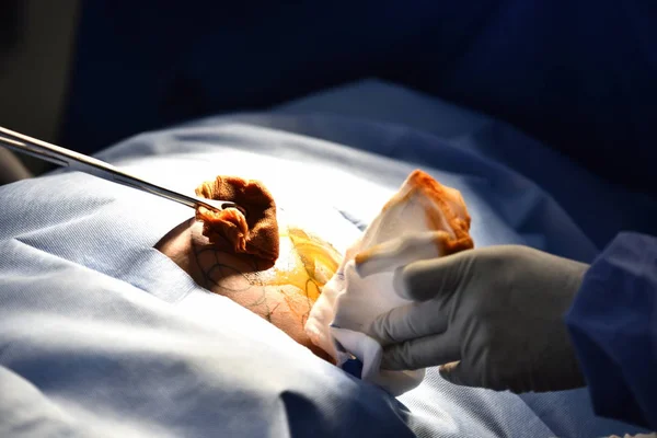 Team Surgeon Work Operating Room Surgical Light Operating Room Preparation — Stock Photo, Image