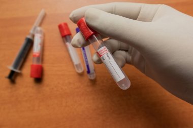 Pro-pıhtılaşma Düz Pıhtı Aktivatör kan toplama tüpü, kırmızı plastik stoper ile elle laboratuvarda düzenlenen, Hindistan