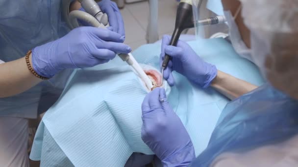 Tandläkarens Händer Blå Handskar Behandla Tänder Kvinnor Bär Skydd Tandläkarmottagningen — Stockvideo