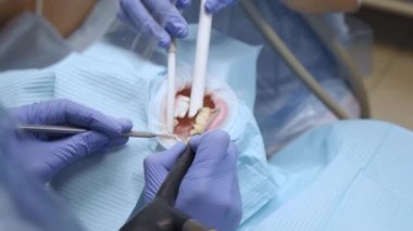 Mavi Eldivenli iki dişçinin diş hekiminde korunan bir kadının dişlerini tedavi etmelerinin yakın çekimi. Sağlık ve Tıp Konsepti.