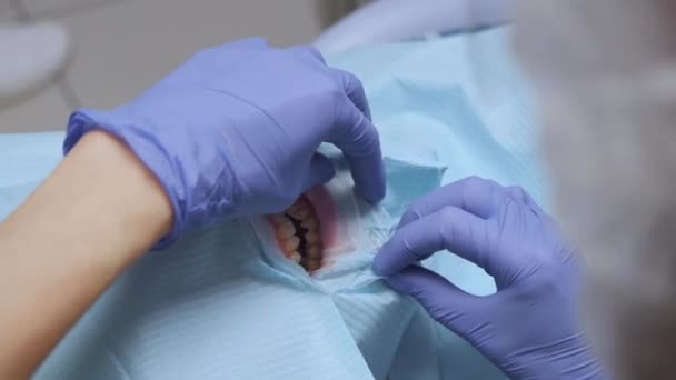 青い手袋で歯科医の手のクローズアップ歯科事務所で保護を身に着けている女性の歯を扱う 医療と医療の概念 — ストック動画