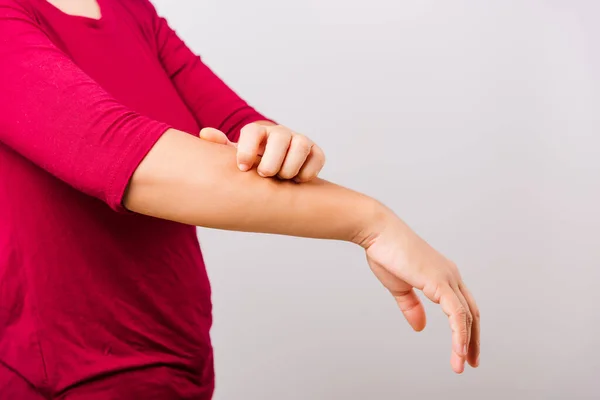 Mujer Hermosa Asiática Que Pica Rascarse Brazo Con Picazón Fondo — Foto de Stock