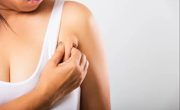 Kvinna Dra Hennes Hud Underarm Hon Problem Armhåla Fett Underarm — Stockfoto