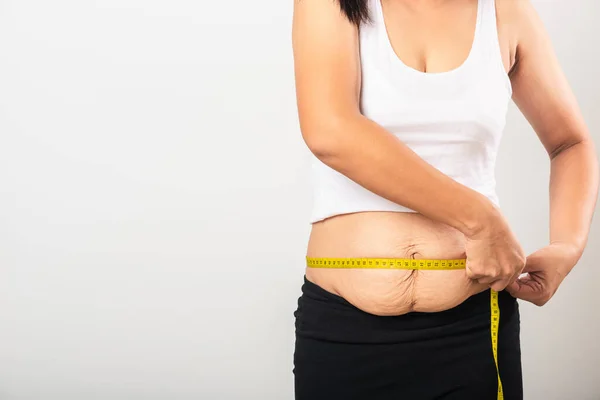 Asiático Mãe Mulher Uso Seção Pós Parto Cicatriz Medição Cintura — Fotografia de Stock