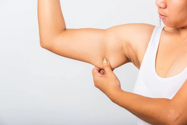 Close Asian Woman Pulling Excess Fat Her Arm Problem Armpit — Stock Photo, Image