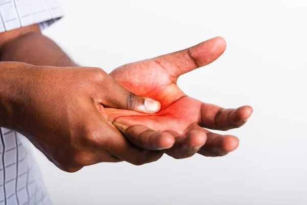 Closeup Hand Asian Black Man Holds His Palm Hand Injury — Stock Photo, Image