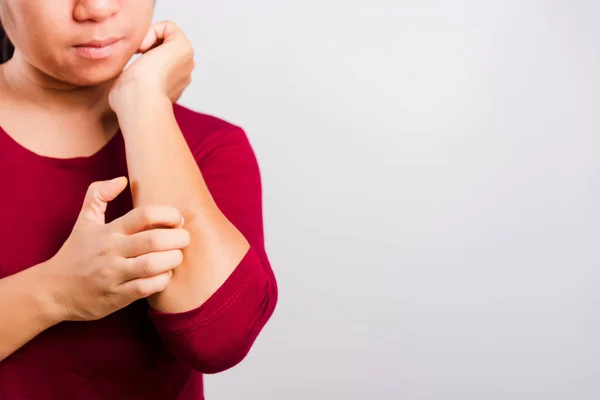 Asian Beautiful Woman Itching Her Scratching Her Itchy Arm White — Stock Photo, Image