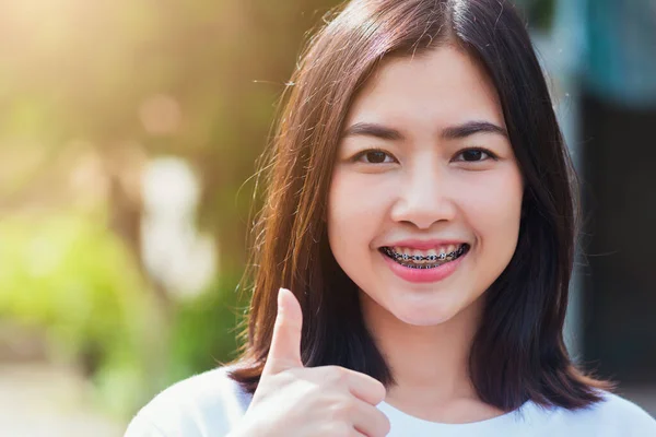 Retrato Adolescente Asiática Hermosa Sonrisa Mujer Tiene Frenos Dentales Los — Foto de Stock