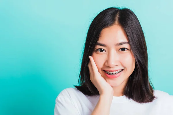 Retrato Ásia Teen Bela Jovem Mulher Sorriso Tem Aparelho Dental — Fotografia de Stock