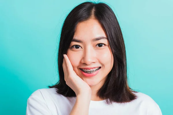 アジアの10代の美しい若い女性の笑顔の肖像彼女は手で彼女の顔に触れる笑って歯の歯のブレースを持っています 青の背景に隔離されたスタジオショット 医学と歯科の概念 — ストック写真