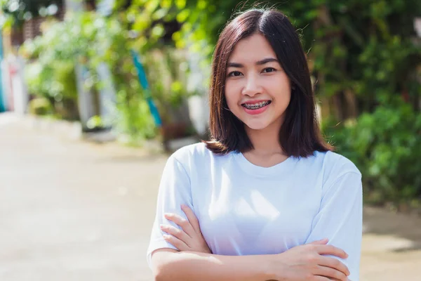 アジアの10代の美しい若い女性の笑顔の肖像画は歯に歯のブレースが屋外で笑っている 医学と歯科の概念 — ストック写真
