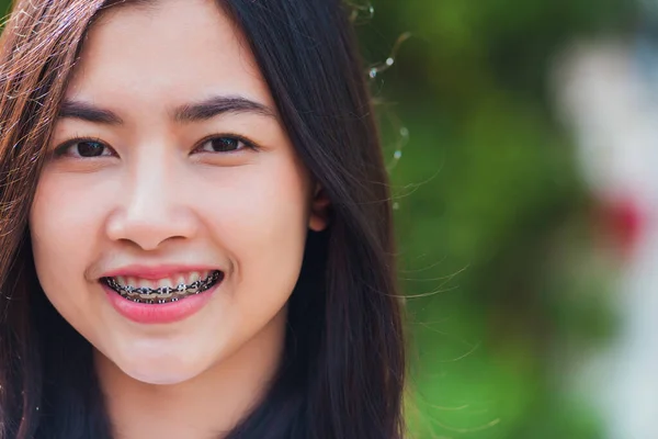 Asyalı Genç Güzel Kadın Gülümsemesinin Diş Telleri Açık Havada Gülüşmeler — Stok fotoğraf