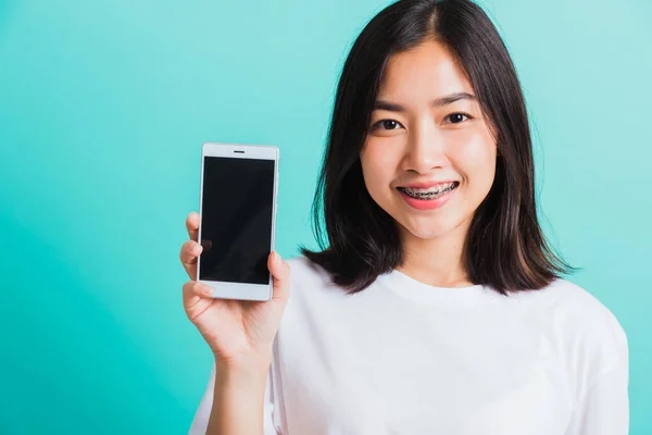 Porträt Von Asiatischen Teenager Schöne Junge Frau Lächeln Haben Zahnspangen — Stockfoto