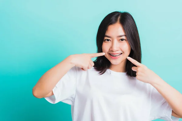 Retrato Ásia Teen Bela Jovem Mulher Sorriso Tem Aparelho Dentário — Fotografia de Stock