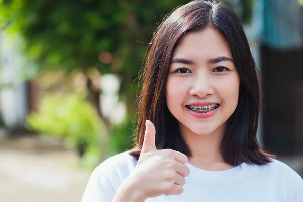 Retrato Ásia Teen Bela Jovem Mulher Sorriso Tem Aparelho Dental — Fotografia de Stock