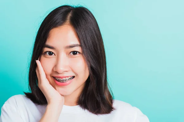 Retrato Adolescente Asiática Hermosa Sonrisa Mujer Tiene Frenos Dentales Los — Foto de Stock