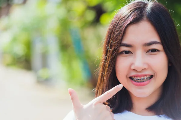 Retrato Ásia Teen Bela Jovem Mulher Sorriso Tem Aparelho Dental — Fotografia de Stock