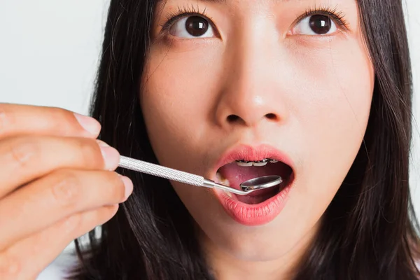 Aziatisch Tiener Mooie Jonge Vrouw Glimlach Hebben Tandheelkundige Beugels Tanden — Stockfoto