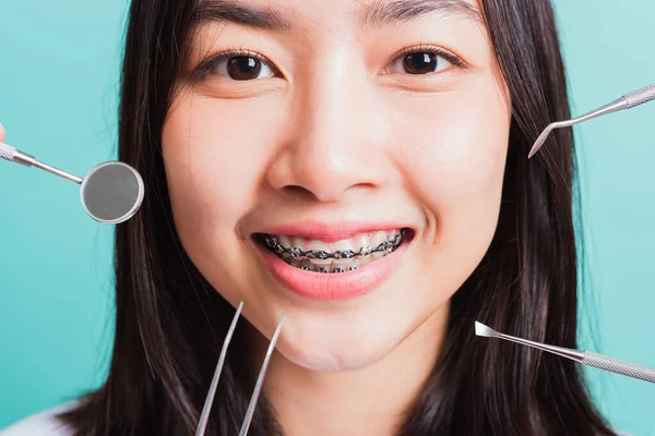 Asiatique Adolescent Belle Jeune Femme Sourire Ont Appareils Dentaires Sur — Photo