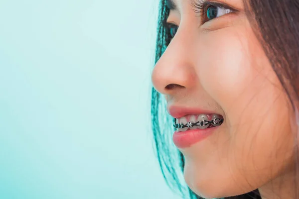 Nahaufnahme Teen Asiatische Schöne Junge Frau Lächeln Haben Zahnspangen Auf — Stockfoto