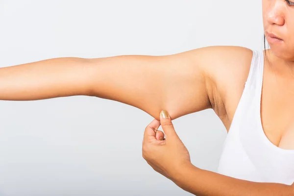 Close Asian Woman Pulling Excess Fat Her Arm Problem Armpit — Stock Photo, Image