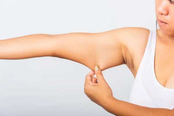 Primer Plano Mujer Asiática Tirando Exceso Grasa Bajo Brazo Problema — Foto de Stock