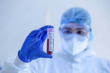 COVID19, Coronavirus ya da Roman Corona salgını için kan testi tüpüne odaklanın. PPE 'deki laboratuvar teknisyeni. Kişisel Koruyucu Ekipman. Hastane laboratuvarında kan tüpü testi yapıyorlar..