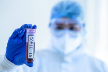 COVID19, Coronavirus ya da Roman Corona salgını için kan testi tüpüne odaklanın. PPE 'deki laboratuvar teknisyeni. Kişisel Koruyucu Ekipman. Hastane laboratuvarında kan tüpü testi yapıyorlar..