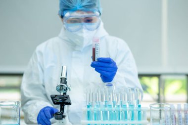 Bilim adamı veya araştırmacı elinde grip, kızamık, koronavirüs, kovid-19 aşı hastalığı taşıyan mavi eldivenlerle insan klinik denemelerine aşı aşısı, ilaç ve ilaç konseptine hazırlanıyor..