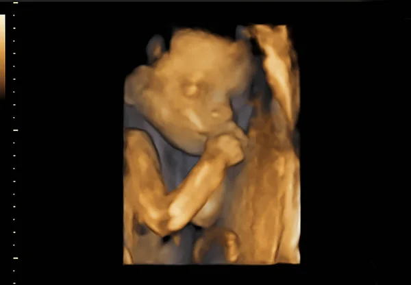Pasgeboren baby in beeld echografie — Stockfoto
