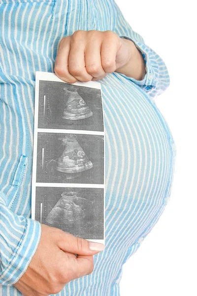 Lycklig gravid flicka ligger på vit bakgrund — Stockfoto