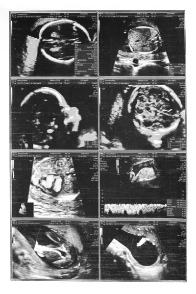 Criança em um fundo de imagem de ultra-som — Fotografia de Stock