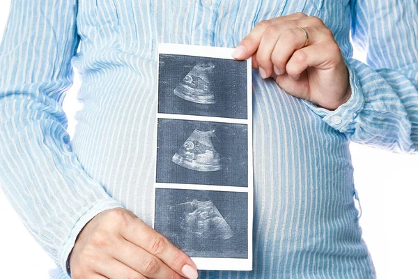 Gelukkig zwanger meisje ligt op wit achtergrond — Stockfoto