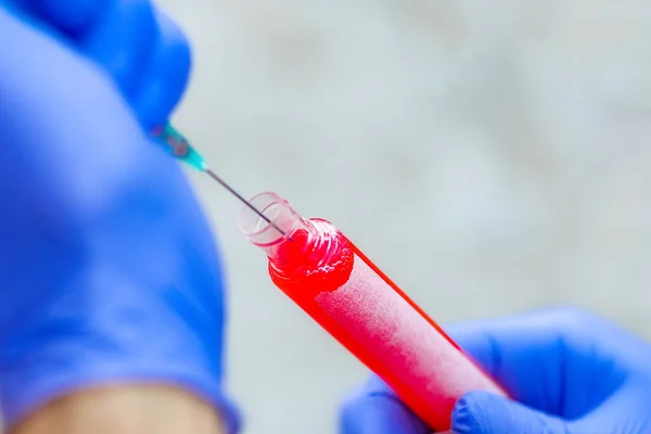 Las Manos Tubo Ensayo Con Sangre Para Análisis Del Virus —  Fotos de Stock