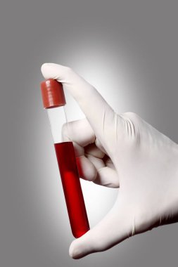 gri arka plan üzerinde bir kan testi tüpü tutan eldiven ile el ve metin için kopya alanı