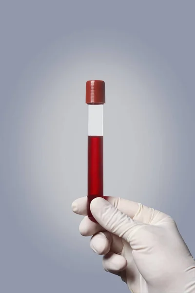 Mão Com Luva Segurando Tubo Teste Sangue Fundo Cinza Espaço — Fotografia de Stock