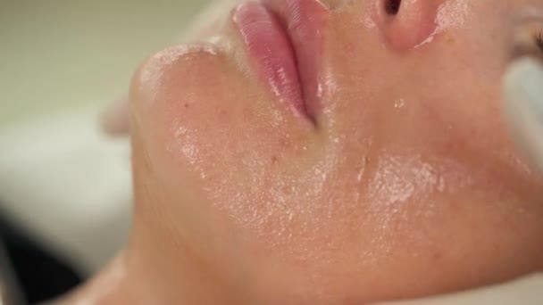 A close up side view of a woman's chin and lips with gel on her skin. Two hands in gloves massage the chin and jawline — Stock Video