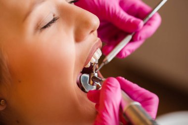 Dişçideki güzel sarışın kadınlar, diş bakımı.