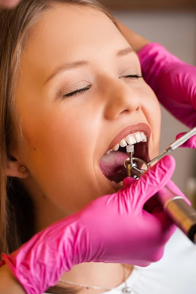 Красивые молодые блондинки у стоматолога, стоматологическая помощь — стоковое фото