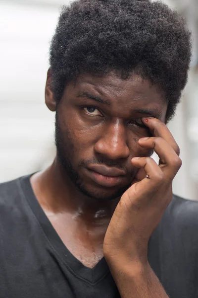 man suffering from irritated eye; sick african man with eye pain, sore eye, optical allergy symptoms; body sickness, eye care, health care or pain concept; adult african man or black man model